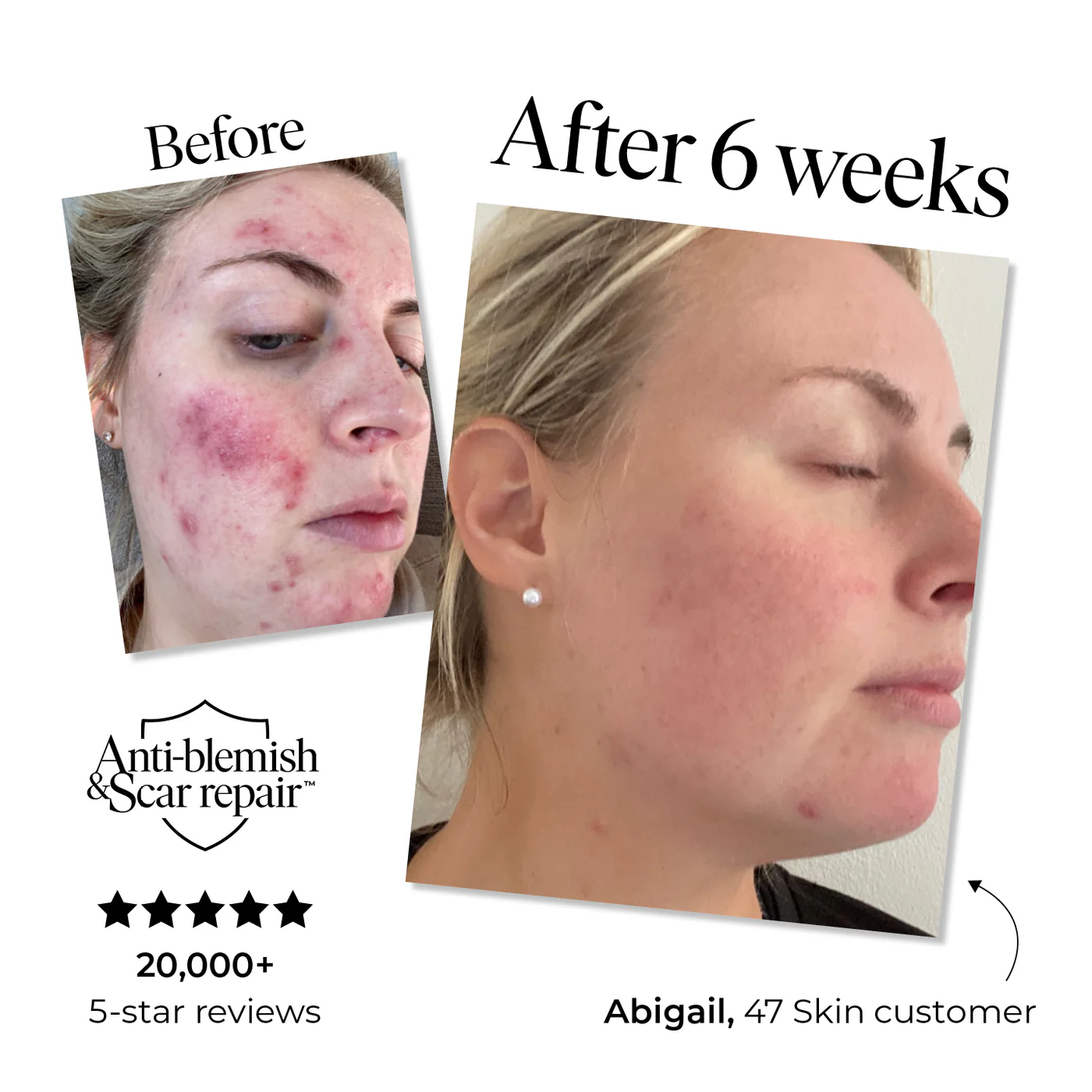 Unlock Your Skin's Miracle Transformation